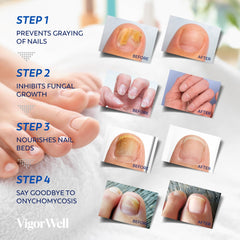 Aplicación de 8 horas para reparación nocturna de uñas.