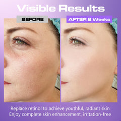 Viktairy Bakuchiol Serum, aplicación con dos gotas para mejor absorción.