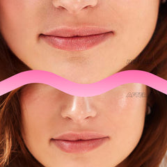 Vitamasques labios con 400 microdardos disolventes para un volumen suave