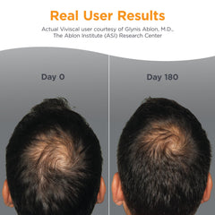 Viviscal Man packaging front highlights the AminoMar collagen complex.