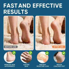 VREKEF Crema Urea 60% en acción, aplicación diaria y rápida absorción.