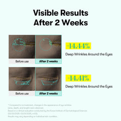 VT COSMETICS PDRN Reedle Shot Eye Cream microneedling spicules close-up promoting better absorption.