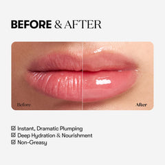 VT COSMETICS Reedle Shot Voluminizador de labios con efecto microagujas para volumen suave.