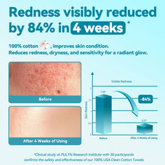Winner disposable face towel ultra soft texture shows plush comfort for daily skincare