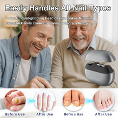 witpiny Polishing feature smooths nail edges safely