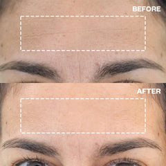 Wrinkles Schminkles night-use forehead patch demonstrates hydration potential