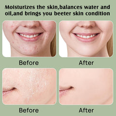 YBHMO aplicacion rostro y cuerpo para una experiencia suave