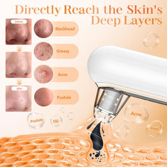 Yccu blackhead remover in action on nose for deep cleansing
