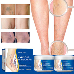 Yetary crema para venas en piernas, enfoque de masaje para mejor absorción.