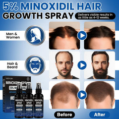 Spray compacto de Minoxidil para viaje y confort
