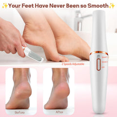 ZABOUL pedicure wand in use for smooth feet care