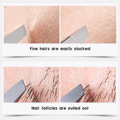 ZERNBER Tweezers Set with etched tips for reliable grip and precision.