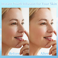 ZJRUI Micro Needling Kit collagen serum supports skin nourishment.