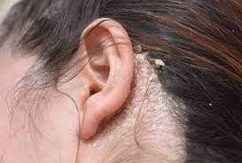 Detalle de uso facial con 111MedCo, limpieza suave para la piel
