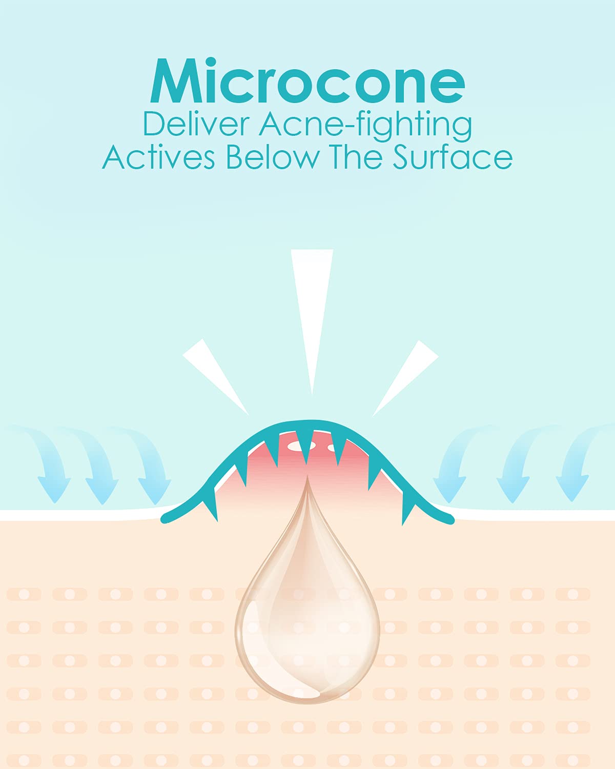 +1HEROLABS Parche acne con acido salicilico para piel sensible.