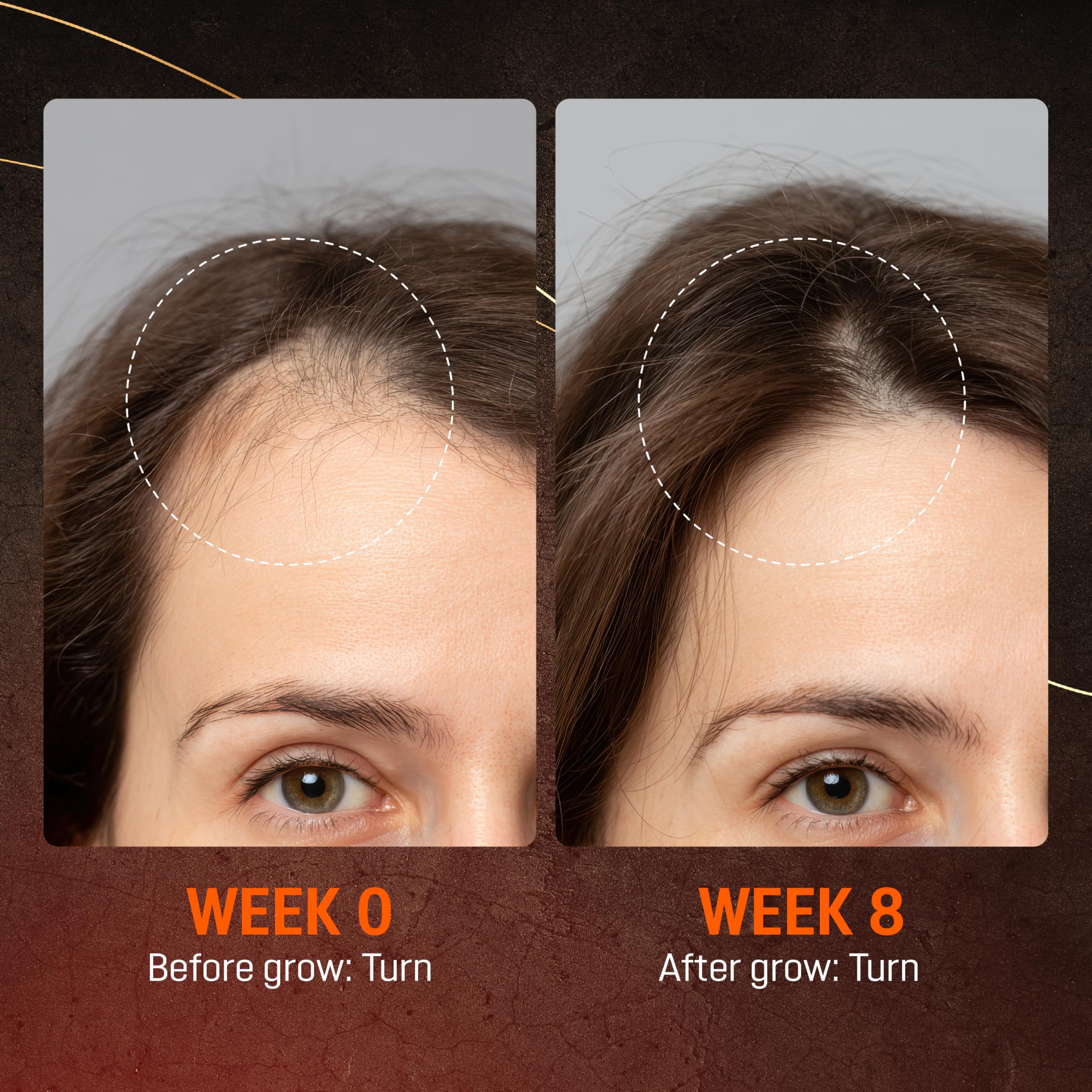 ABERA hair growth serum label close-up with Biotin and Castor Oil branding.