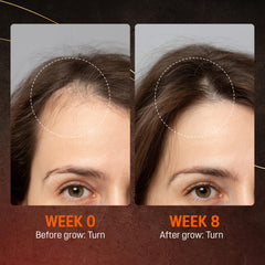 ABERA hair growth serum label close-up with Biotin and Castor Oil branding.