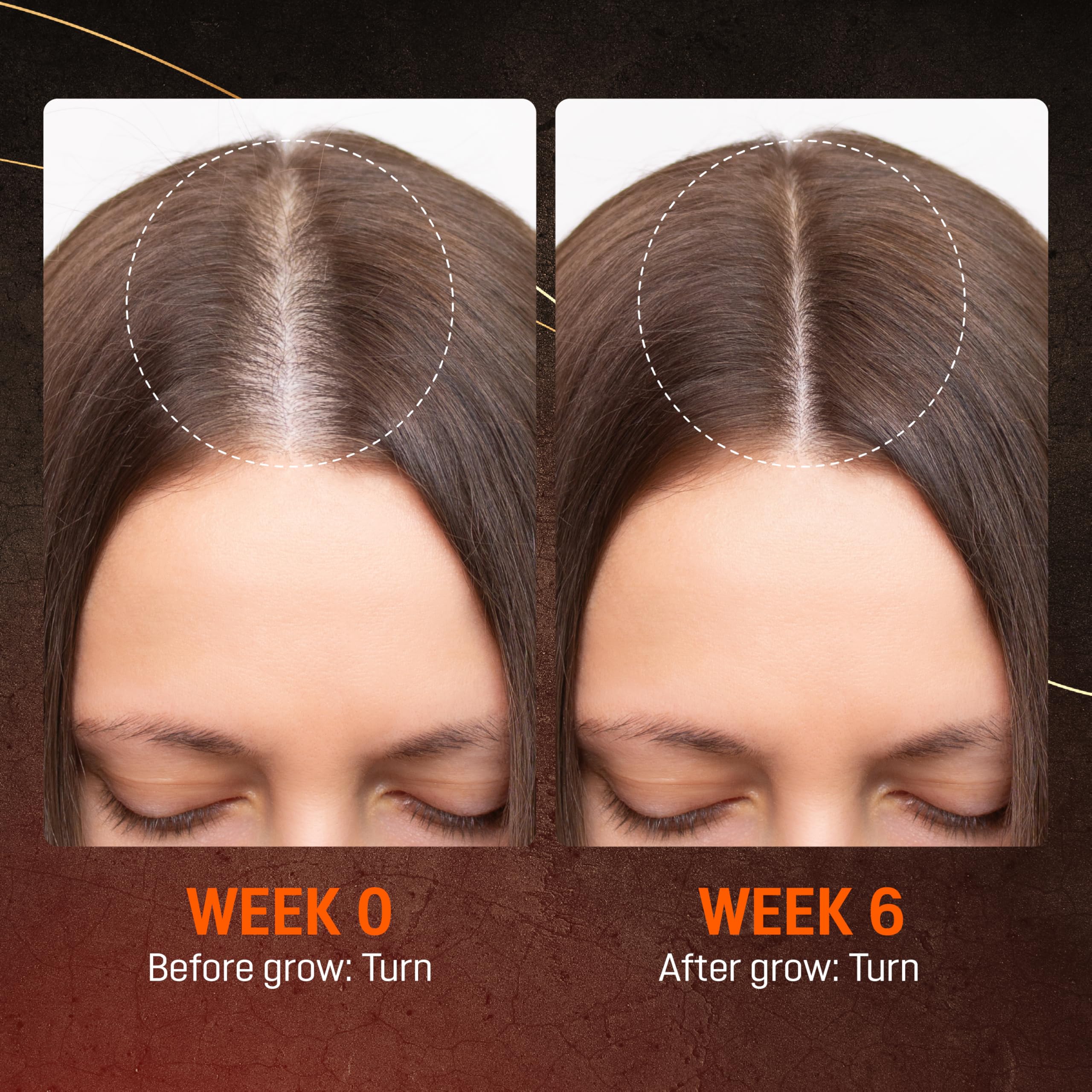 ABERA hair growth serum packaging box showing product details.