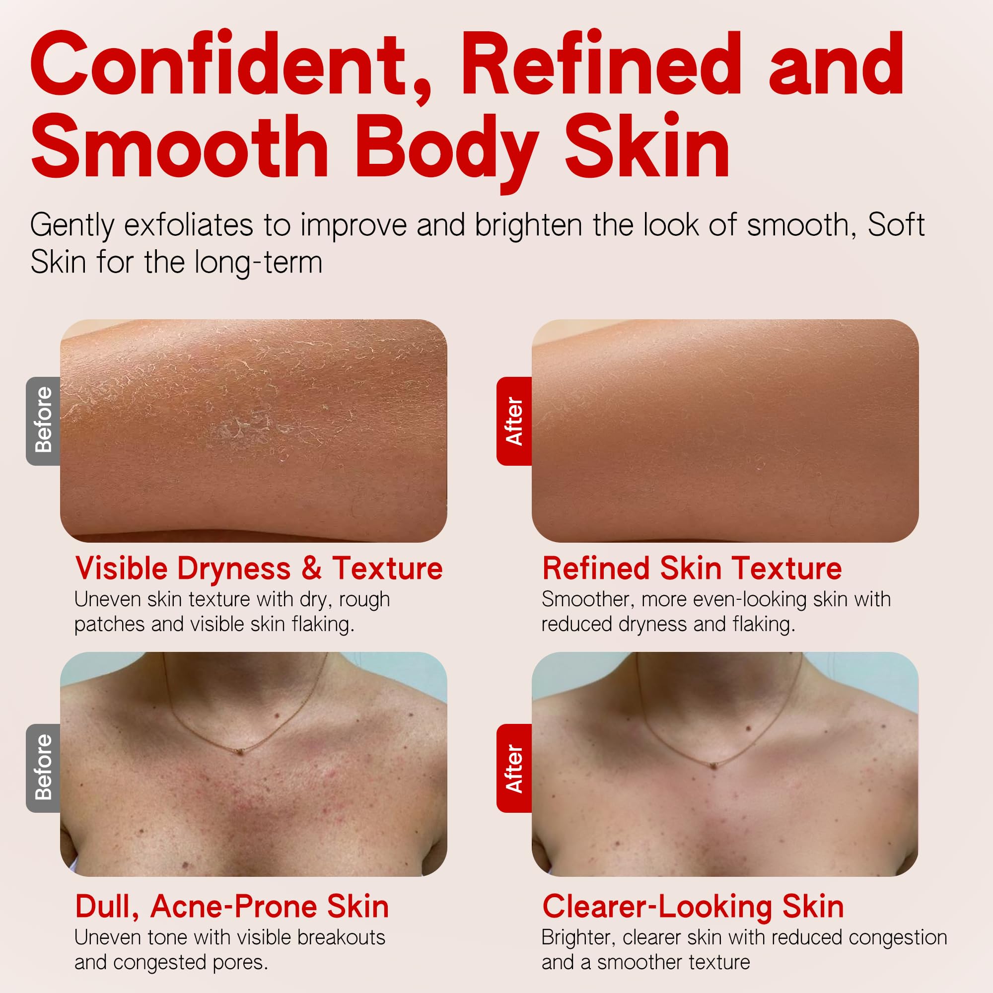 ABI AME ingredients close-up highlights glycolic and salicylic acids for gentle renewal