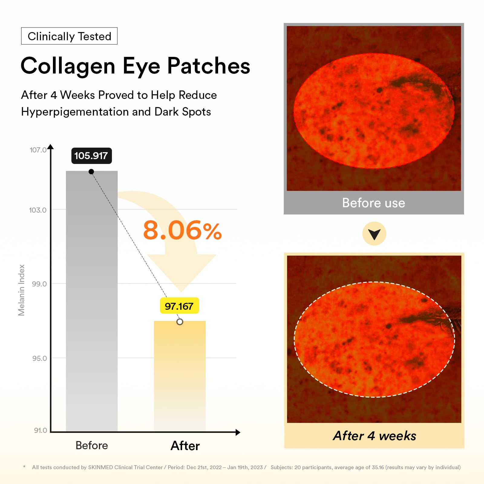 Multi-area application works on forehead and smile lines for versatility.