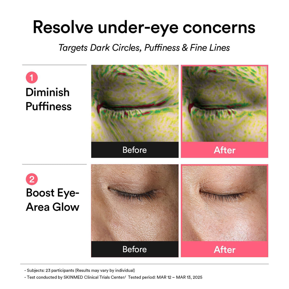 Abib PDRN Retinal Eye Patches featuring Niacinamide for skin renewal