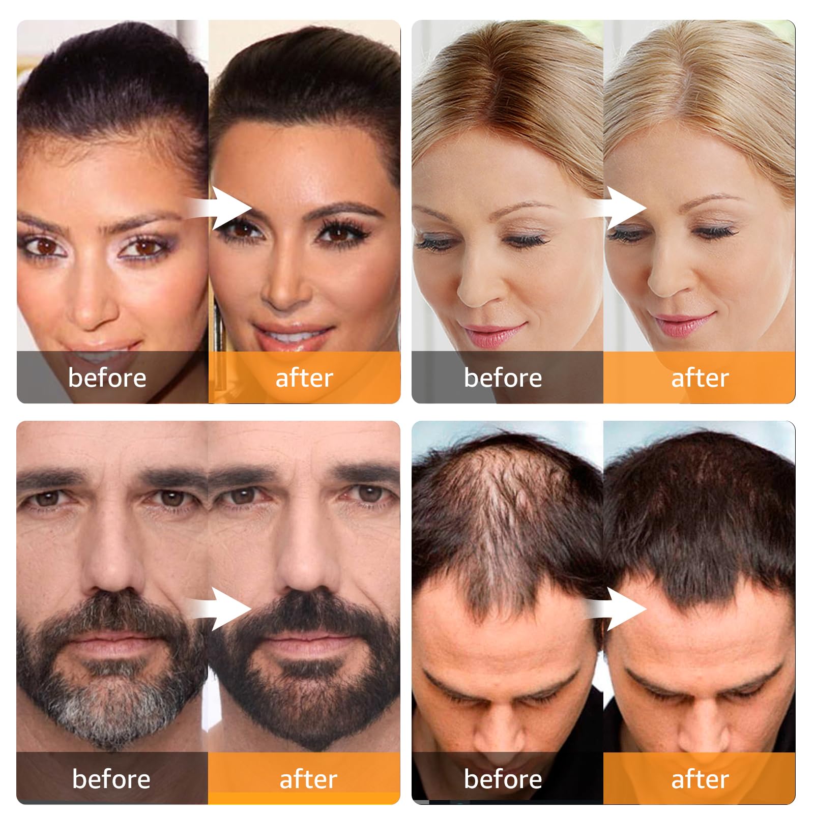 Abomet Hairline Powder Compact conceals thinning areas with a seamless finish.