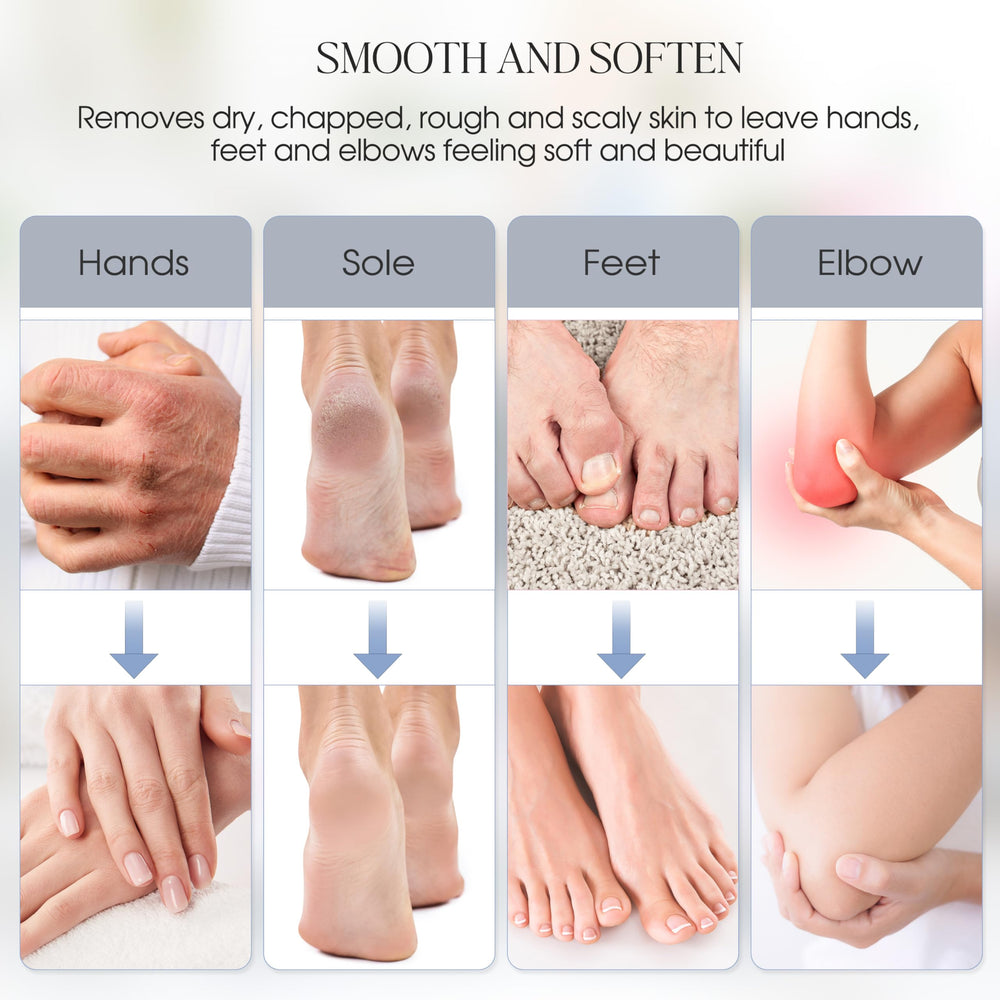 Achzzy soft-skin results after warmth and moisturization.