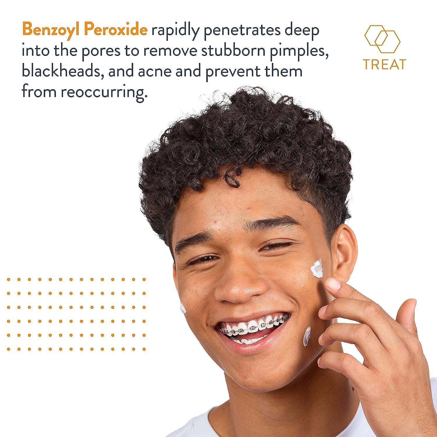 AcneFree Terminator 10 applying dot on blemish demonstrates precise spot treatment.