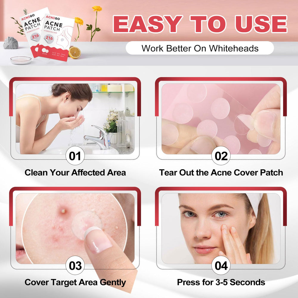 AcneGo 216-count bulk pack delivers daily spot care.