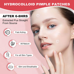 AcneGo absorbs pus and speeds healing for targeted blemishes.