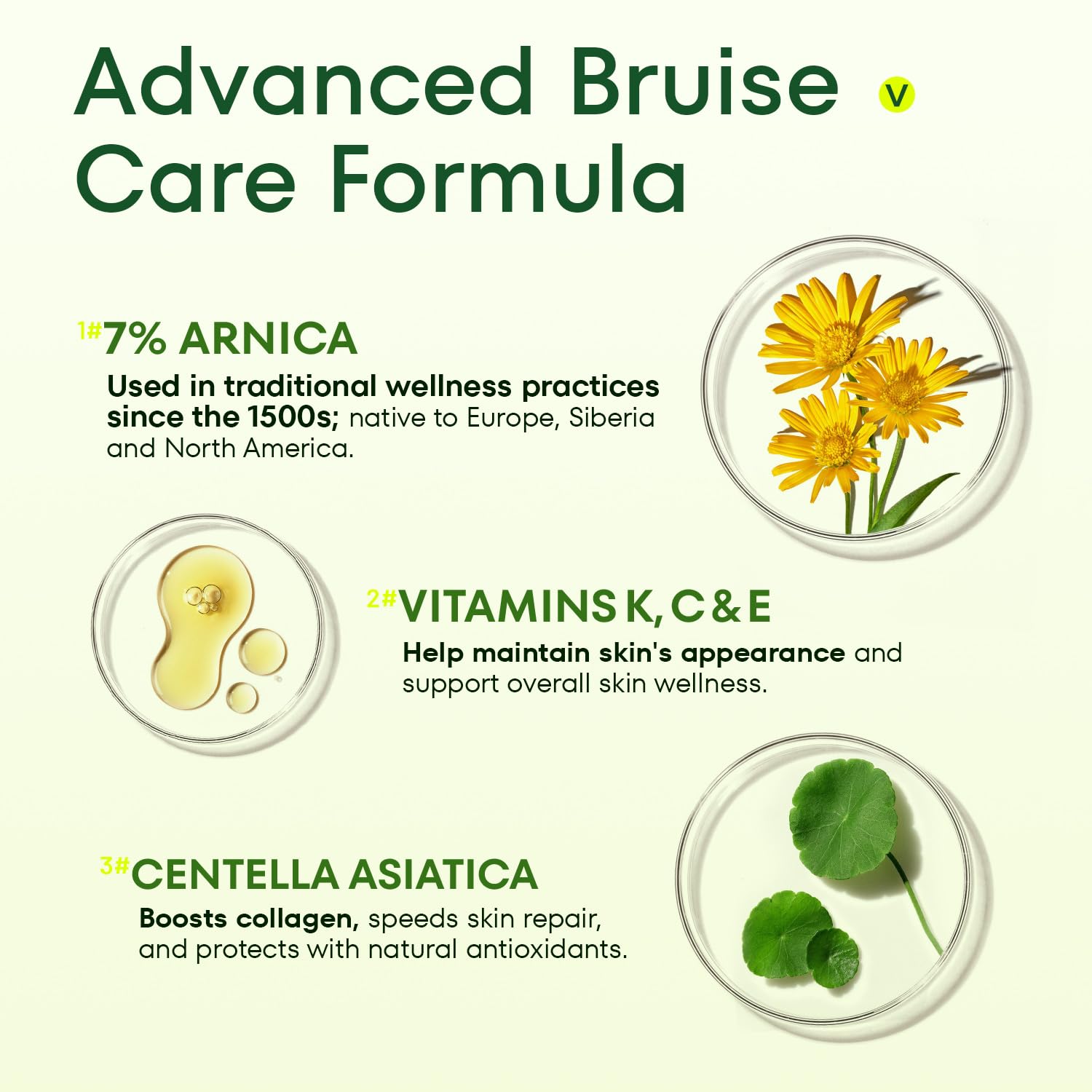 Crema Acolye Arnica para piernas con hematomas, mejora la apariencia de marcas.