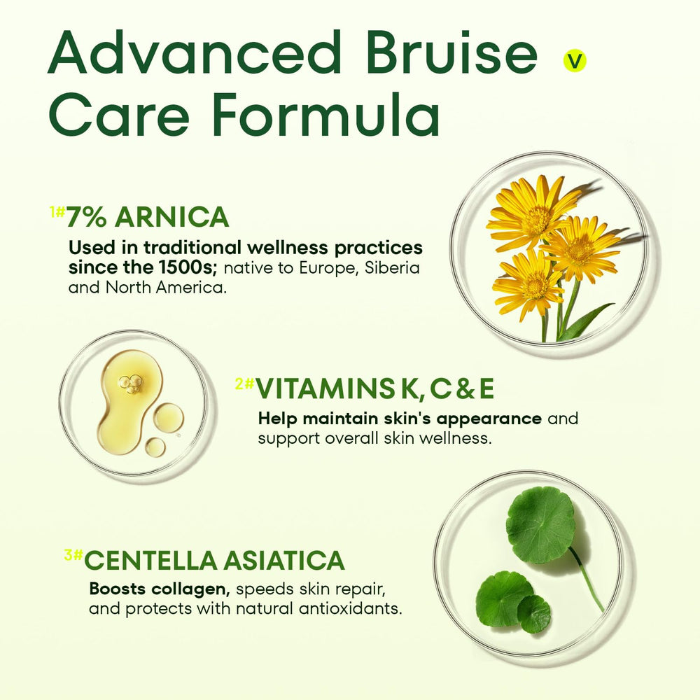 Crema Acolye Arnica para piernas con hematomas, mejora la apariencia de marcas.