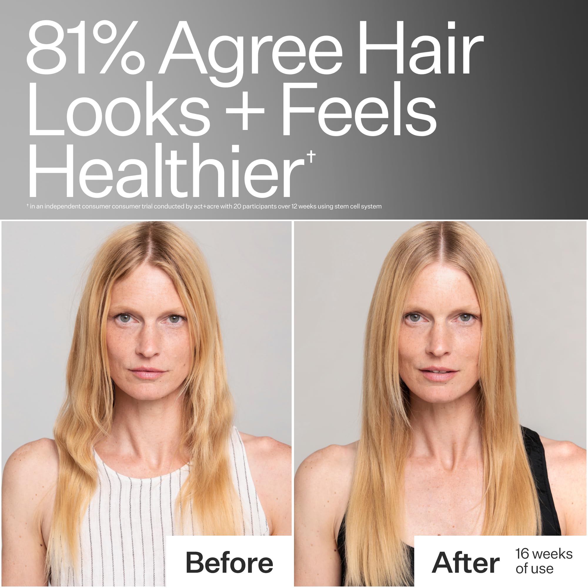 ACT+ ACRE Stem Cell Shampoo foam lather demonstrates gentle cleansing for buildup.