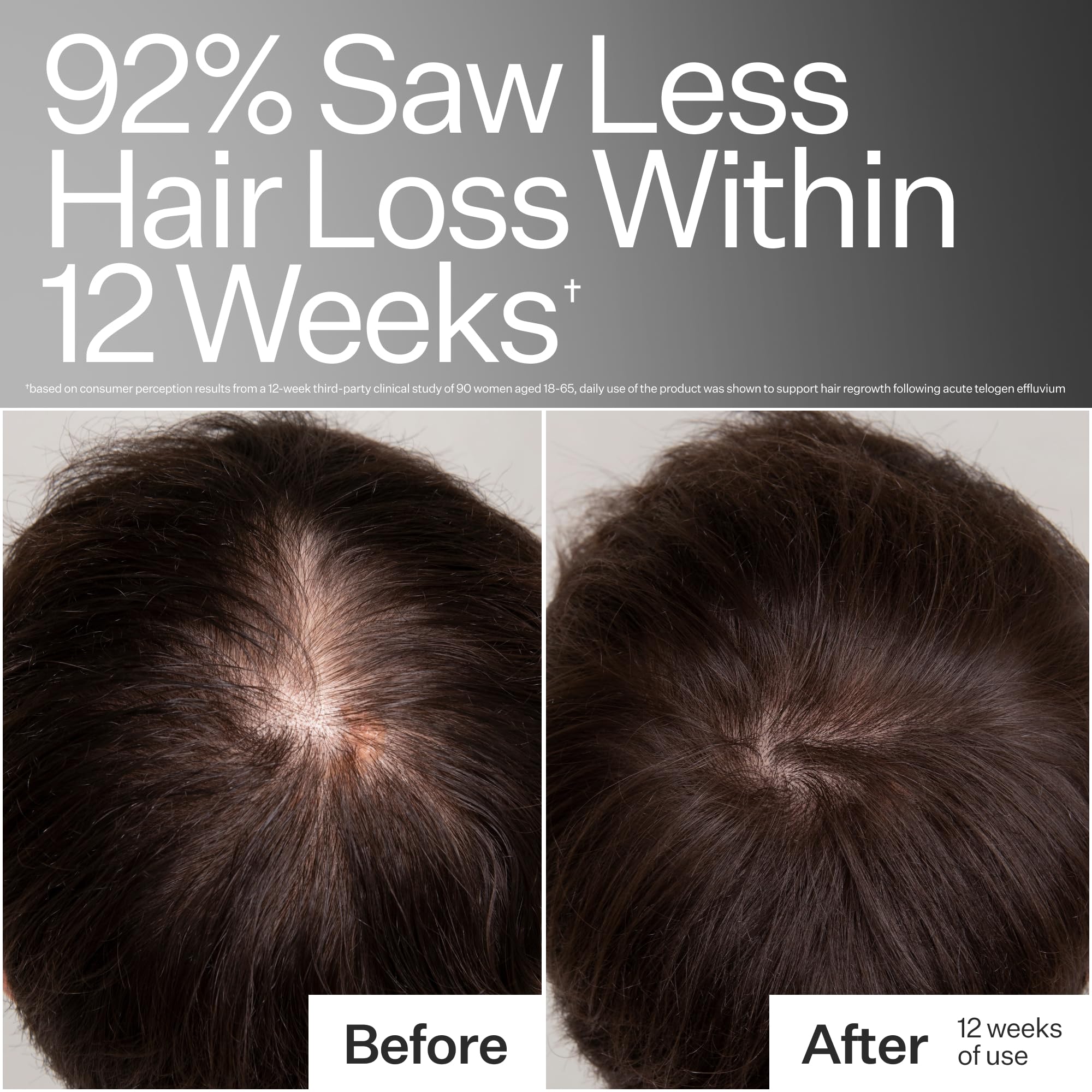 Caffeine boost for scalp shown with ACT+ ACRE imagery