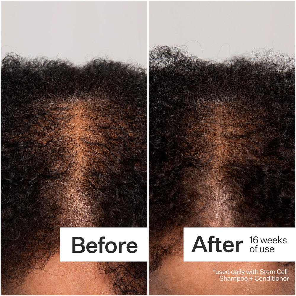 Gentle scalp massage aids absorption of ACT+ ACRE