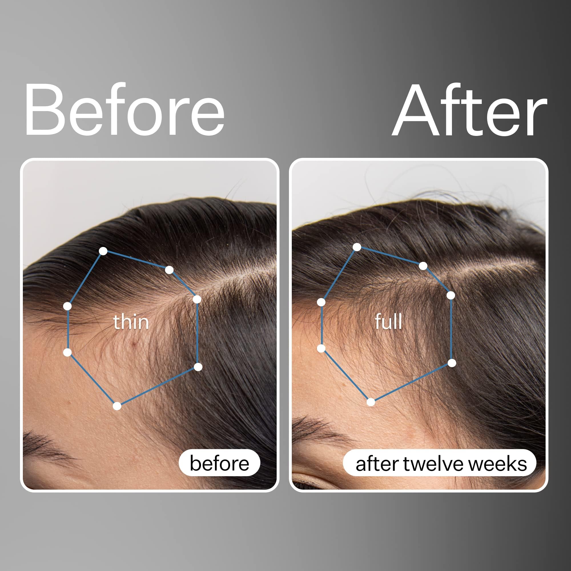 ACT+ ACRE Swiss Apple stem cells visual supports scalp vitality and healthier follicles