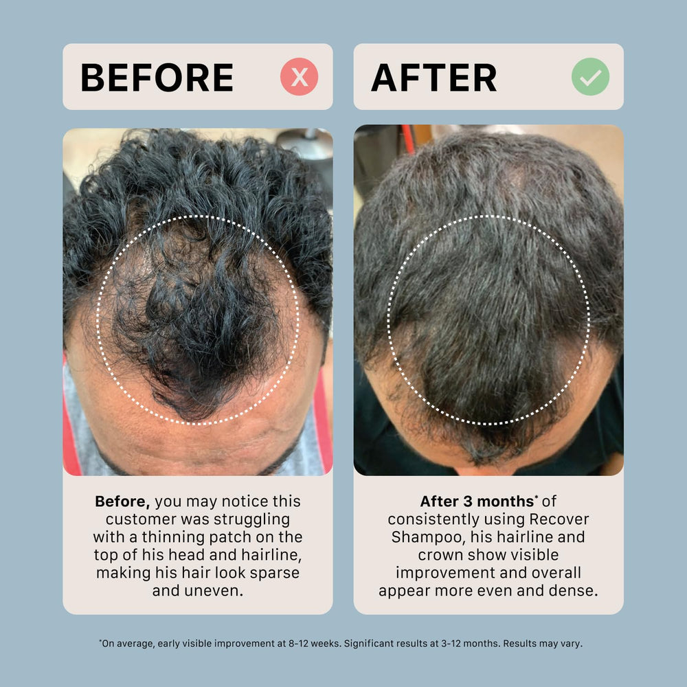 ACTIIV Recover Thickening Shampoo ingredients spotlight plant-based botanicals