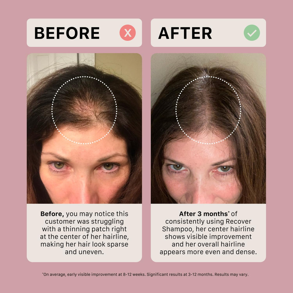 ACTIIV Recover thickening shampoo packaging box signals premium beauty care.