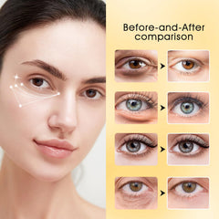Adofect patch with hyaluronic acid delivers moisture for plump under-eye skin
