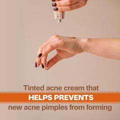 Adult Acnomel limpieza de poros para controlar grasa y brillo.