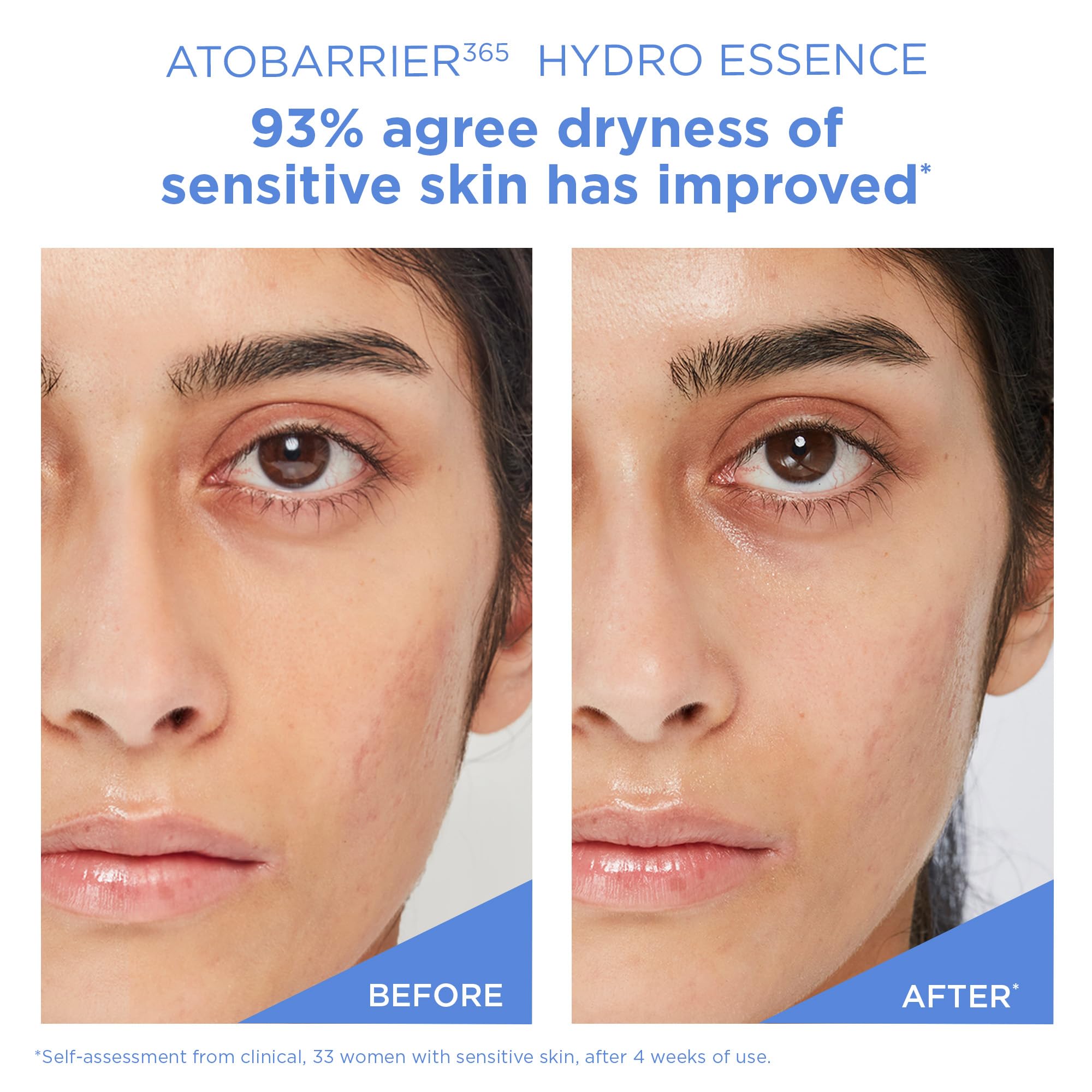 Packaging box communicates fragrance-free and allergy-tested features for AESTURA Hydro Essence.