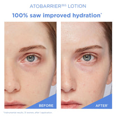 AESTURA ATOBARRIER365 sensitive-skin test demonstrates calm, comfortable feel.