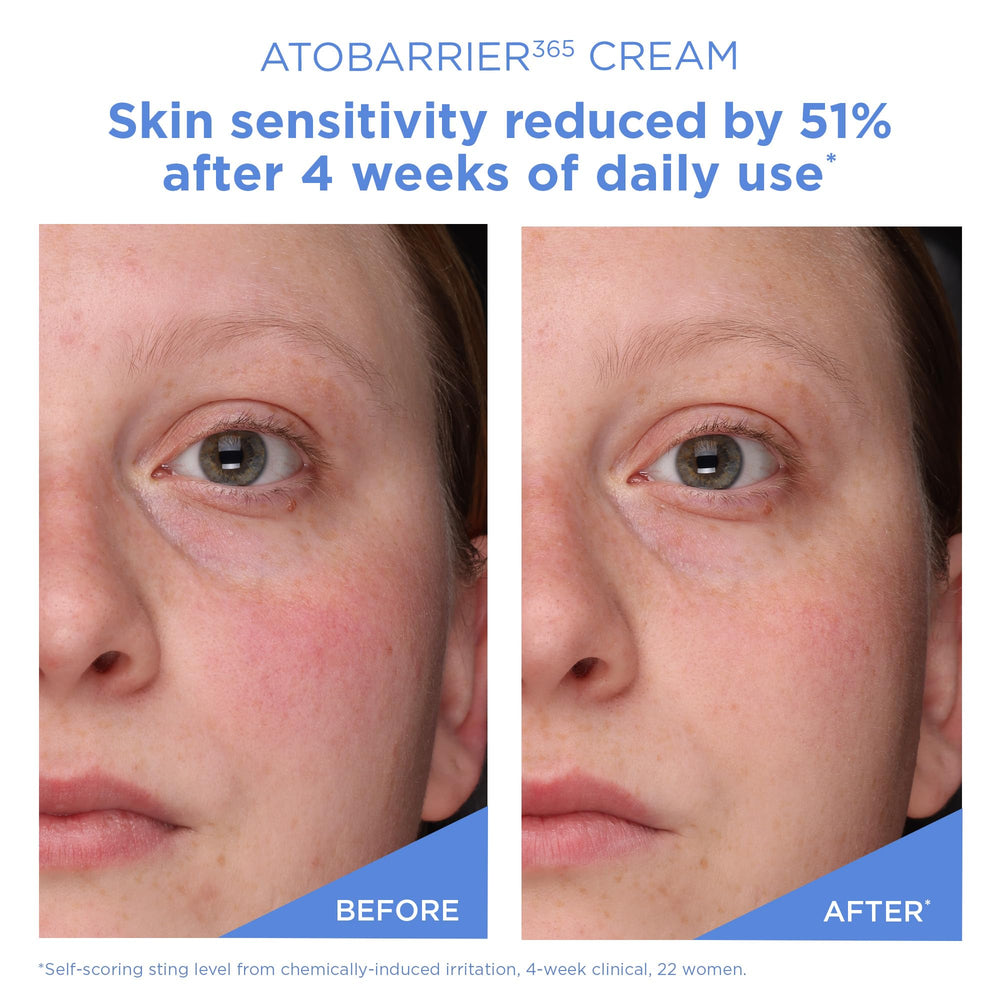 Allergy-tested badge on AESTURA ATOBARRIER365 indicating suitability for sensitive skin
