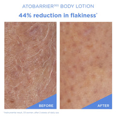 Applying AESTURA ATOBARRIER365 on the arm demonstrates easy, fast absorption.
