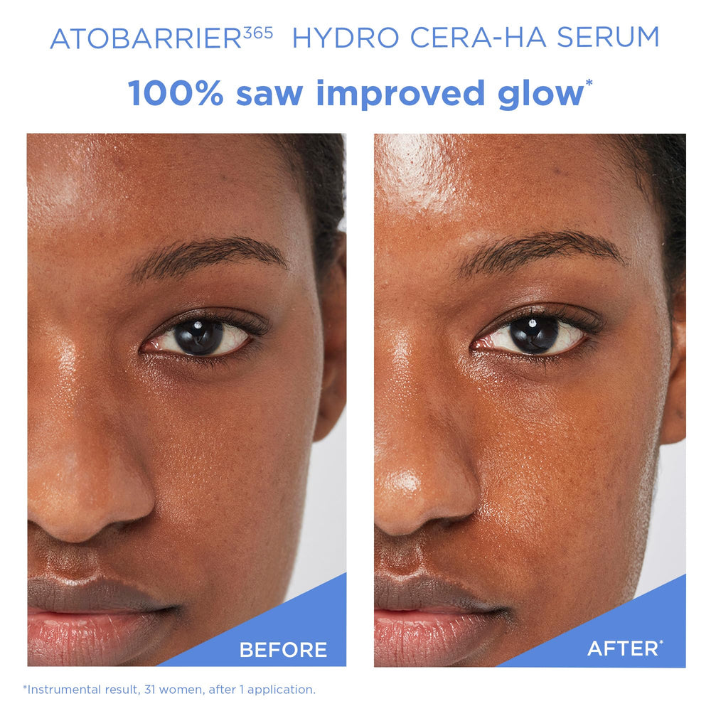 AESTURA ATOBARRIER365 barrier-friendly formula portrait emphasizes skin comfort