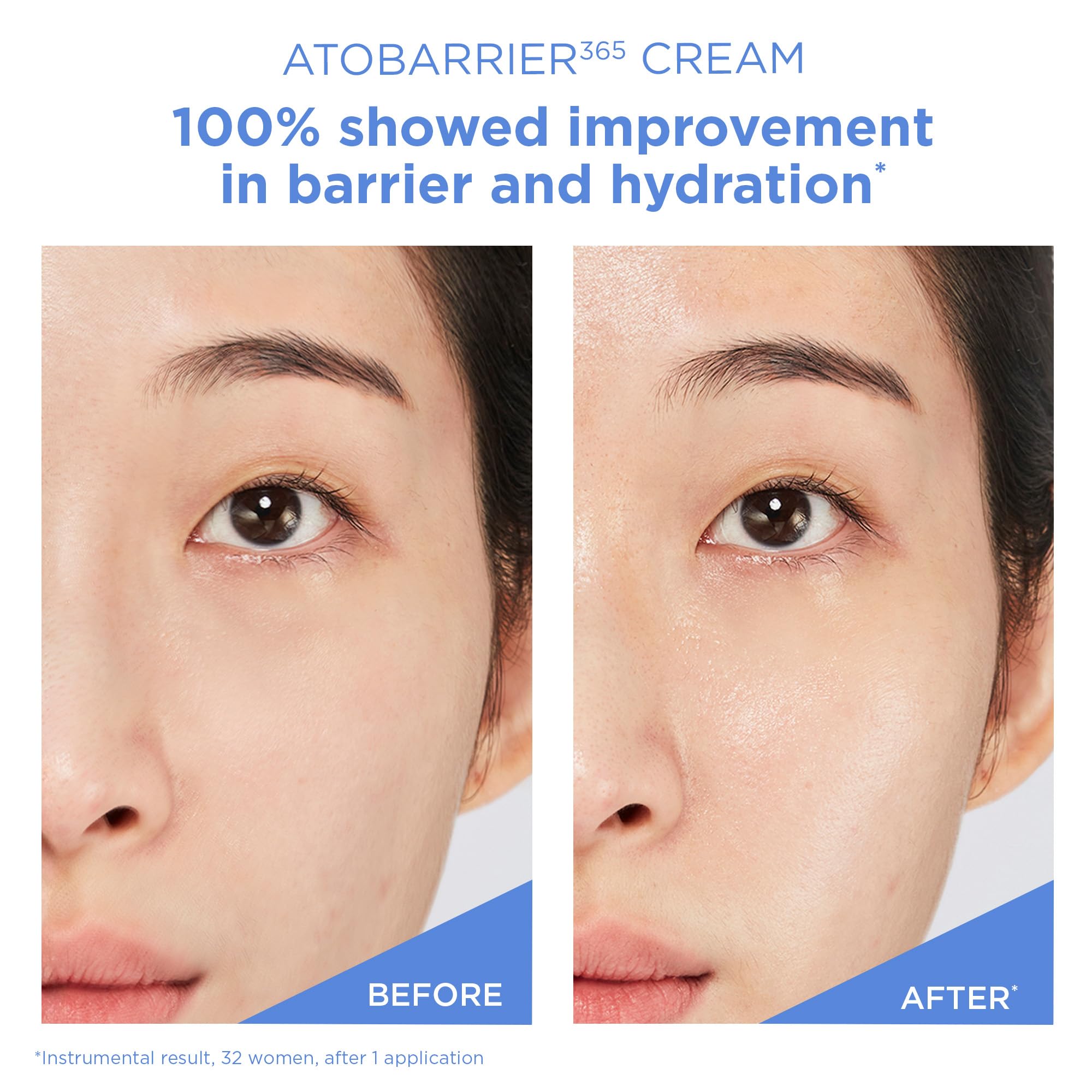 Derm-tested seal on AESTURA ATOBARRIER365 for safe post-procedure use