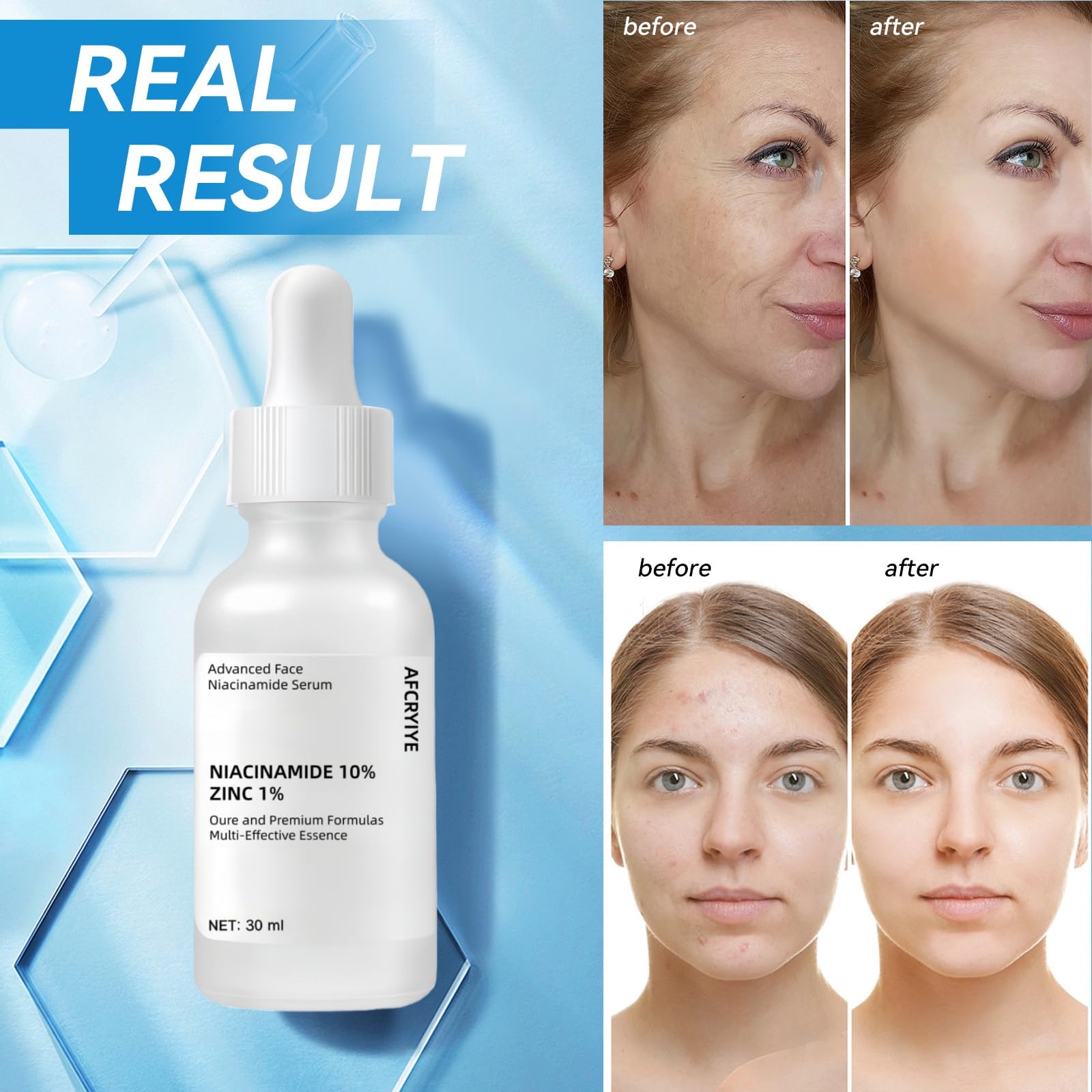 Packaging image of AFCRYIYE Niacinamide serum with outer box.