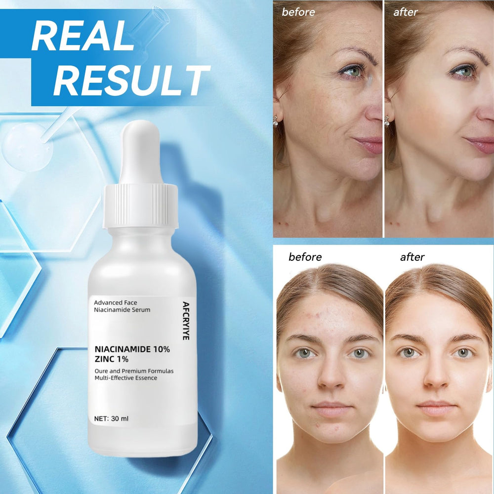 Packaging image of AFCRYIYE Niacinamide serum with outer box.