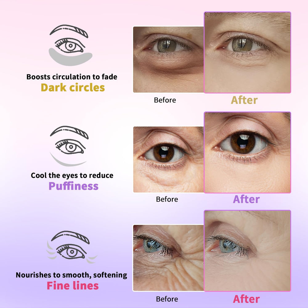 Parches AILEORY cafeína para reducir hinchazón y cansancio de ojos.