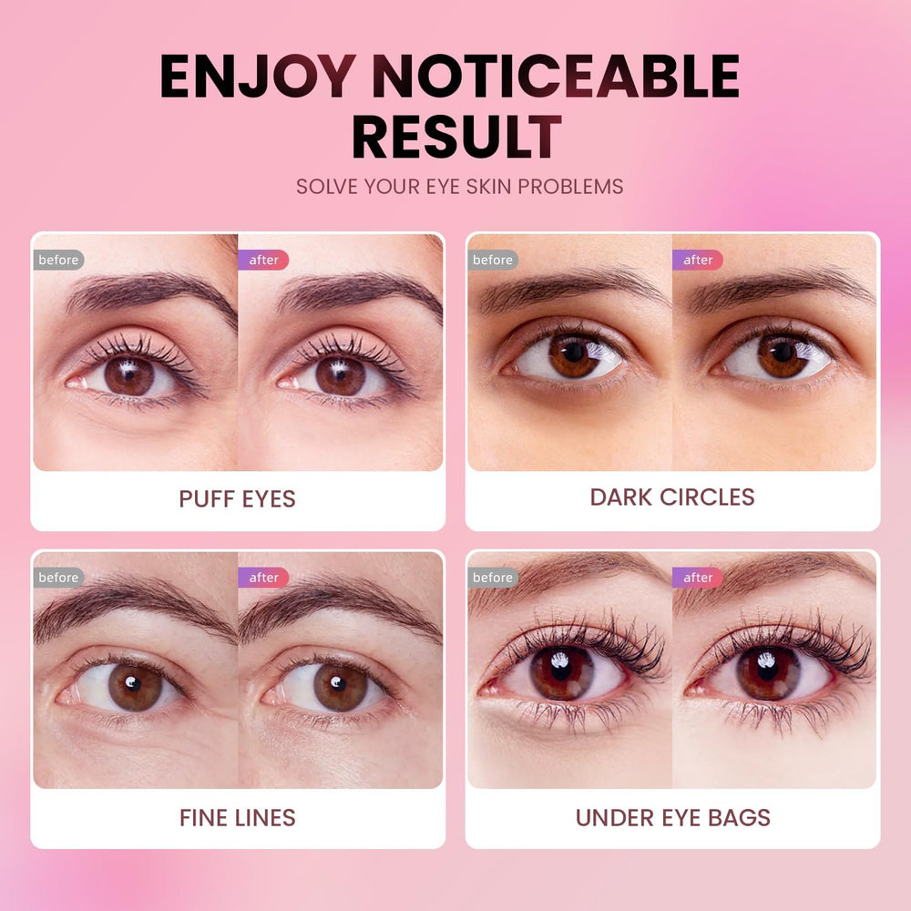 Parche ocular AILEORY textura gel suave para uso diario.